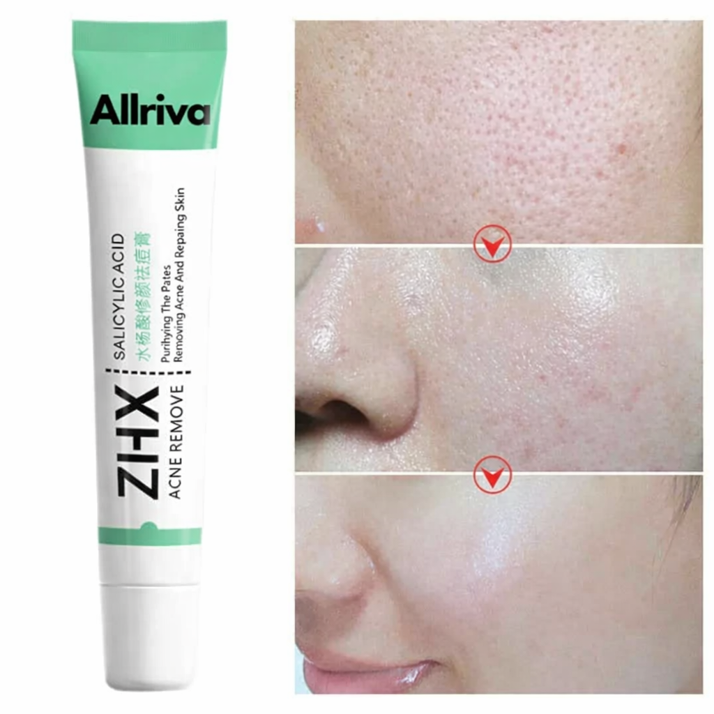 Alluriva Clear Skin Cream